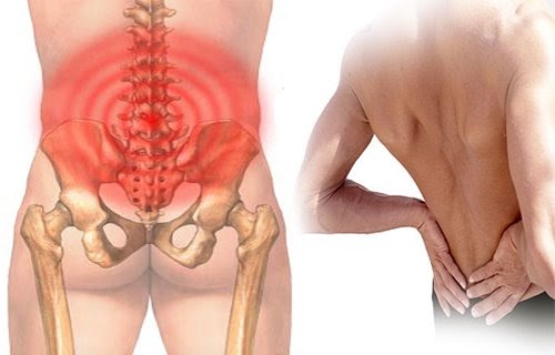 Biểu hiện đau cột sống thắt lưng