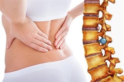 Những nguyên nhân nào gây đau lưng cho phụ nữ?