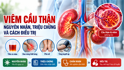 Viêm cầu thận: Nguyên nhân, triệu chứng và cách điều trị